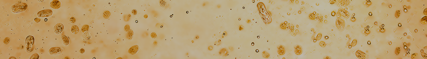 Bacterial Vaginosis (BV)