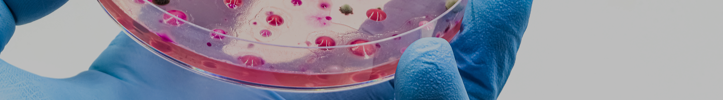 Yeast Infections